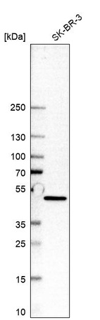 Western blot analysis in human cell line SK-BR-3.