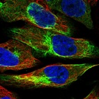 Immunofluorescent staining of human cell line U-2 OS shows localization to intermediate filaments.