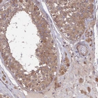 Anti-INCA1 Antibody