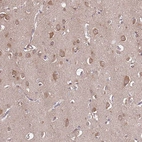 Immunohistochemical staining of human cerebral cortex shows moderate cytoplasmic positivity in neurons.