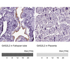 Anti-GAS2L2 Antibody