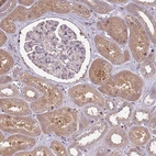 Immunohistochemical staining of human kidney shows moderate cytoplasmic positivity in cells in tubules.