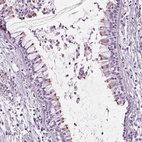 Anti-GAS2L2 Antibody