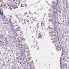 Immunohistochemical staining of human nasopharynx shows positivity in ciliated cells.