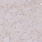Immunohistochemical staining of human skeletal muscle shows very weak cytoplasmic positivity in myocytes.