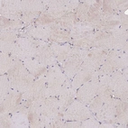 Immunohistochemical staining of human skeletal muscle shows very weak cytoplasmic positivity in myocytes.