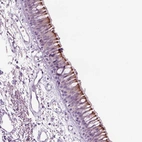 Immunohistochemical staining of human bronchus shows positivity in ciliated cells.