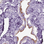 Anti-GAS2L2 Antibody