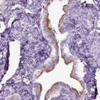 Immunohistochemical staining of human fallopian tube shows strong positivity in cilia in glandular cells.