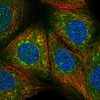 Immunofluorescent staining of human cell line MCF7 shows localization to the Golgi apparatus.