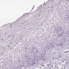 Immunohistochemical staining of human cervix, uterine shows no cytoplasmic positivity in squamous epithelial cells as expected.