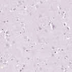 Anti-GAS2L2 Antibody