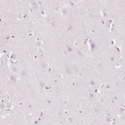 Immunohistochemical staining of human cerebral cortex shows no cytoplasmic positivity in neuronal cells as expected.