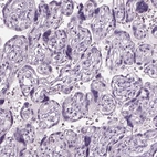 Immunohistochemical staining of human placenta shows no cytoplasmic positivity in trophoblastic cells as expected.