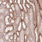 Anti-ZNF623 Antibody