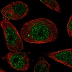 Immunofluorescent staining of human cell line PC-3 shows localization to nucleus.