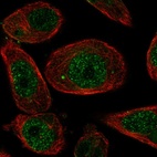 Anti-ZNF623 Antibody