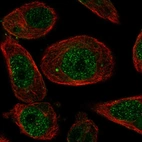 Immunofluorescent staining of human cell line PC-3 shows localization to nucleus.