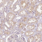 Immunohistochemical staining of human kidney shows moderate cytoplasmic positivity in cells in tubules.