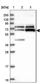 Lane 1: Marker [kDa] 250, 130, 95, 72, 55, 36, 28, 17, 10_br/_Lane 2: Human cell line RT-4_br/_Lane 3: Human cell line U-251MG sp