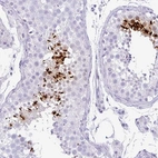 Immunohistochemical staining of human testis shows high expression.