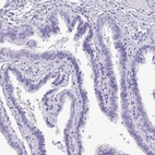 Immunohistochemical staining of human fallopian tube shows low expression as expected.
