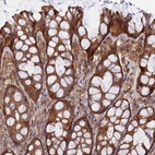 Anti-ABHD1 Antibody