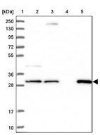 Lane 1: Marker [kDa] 250, 130, 95, 72, 55, 36, 28, 17, 10_br/_Lane 2: Human cell line RT-4_br/_Lane 3: Human cell line U-251MG sp_br/_Lane 4: Human plasma (IgG/HSA depleted)_br/_Lane 5: Human liver tissue