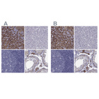 Immunohistochemical staining of human adrenal gland, liver, lymph node and testis using Anti-FDXR antibody HPA044393 (A) shows similar protein distribution across tissues to independent antibody HPA053673 (B).