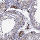 Immunohistochemical staining of human testis shows strong granular cytoplasmic positivity in Leydig cells.