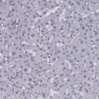 Immunohistochemical staining of human liver shows no positivity in hepatocytes as expected.