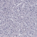 Immunohistochemical staining of human liver shows no positivity in hepatocytes as expected.