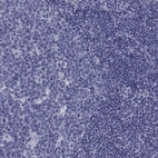 Immunohistochemical staining of human lymph node shows no positivity in non-germinal center cells as expected.