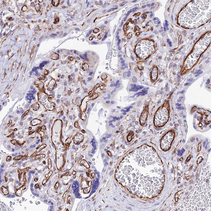 Anti-ZNF652 Antibody