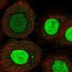 Immunofluorescent staining of human cell line A-431 shows localization to nucleus.