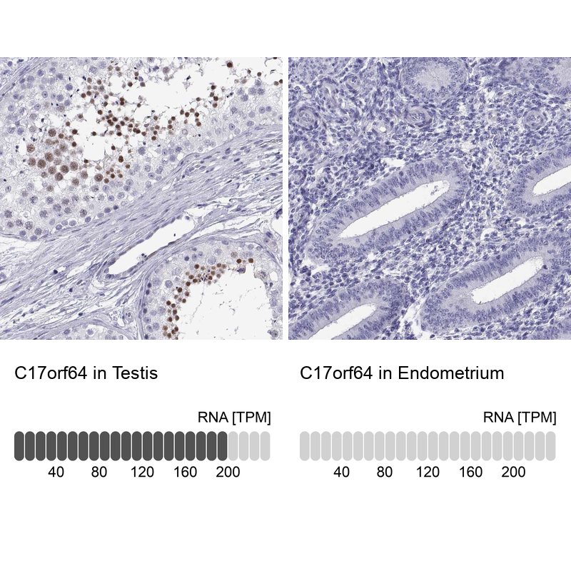 Anti-C17orf64 Antibody