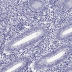 Immunohistochemical staining of human endometrium shows low expression as expected.