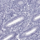 Immunohistochemical staining of human endometrium shows low expression as expected.