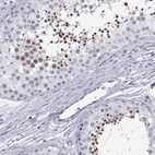 Immunohistochemical staining of human testis shows high expression.