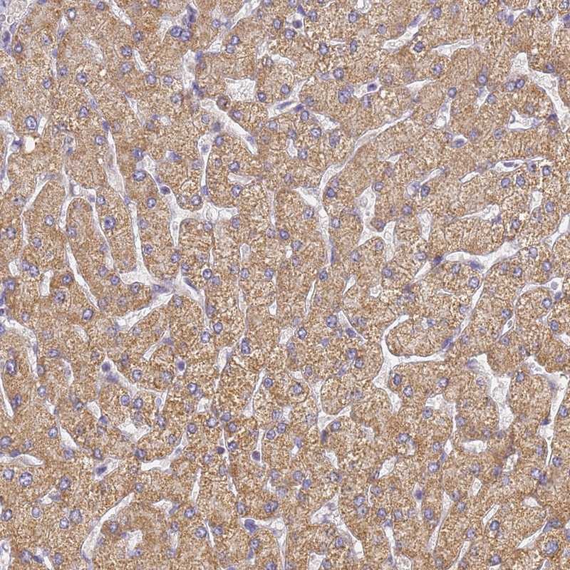 Anti-UTP23 Antibody