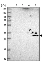 Lane 1: Marker [kDa] 250, 130, 95, 72, 55, 36, 28, 17, 10_br/_Lane 2: Human cell line RT-4_br/_Lane 3: Human cell line U-251MG sp_br/_Lane 4: Human plasma (IgG/HSA depleted)_br/_Lane 5: Human liver tissue