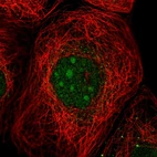 Immunofluorescent staining of human cell line A-431 shows localization to nucleoli.