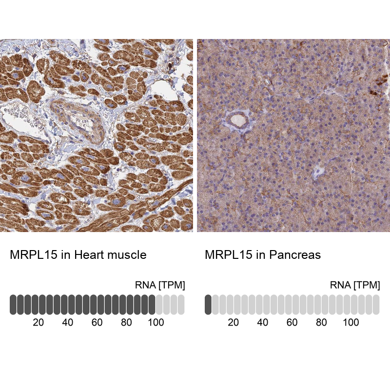 Anti-MRPL15 Antibody