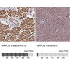 Anti-MRPL15 Antibody