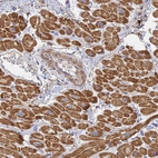 Immunohistochemical staining of human heart muscle shows high expression.
