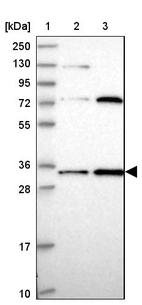 Lane 1: Marker [kDa] 250, 130, 95, 72, 55, 36, 28, 17, 10_br/_Lane 2: Human cell line RT-4_br/_Lane 3: Human cell line U-251MG sp