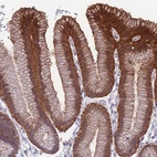 Anti-RTN4RL1 Antibody