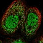 Immunofluorescent staining of human cell line A-431 shows localization to nucleoplasm & cytosol.