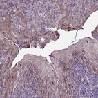 Anti-NOL8 Antibody