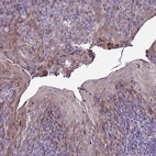 Anti-NOL8 Antibody